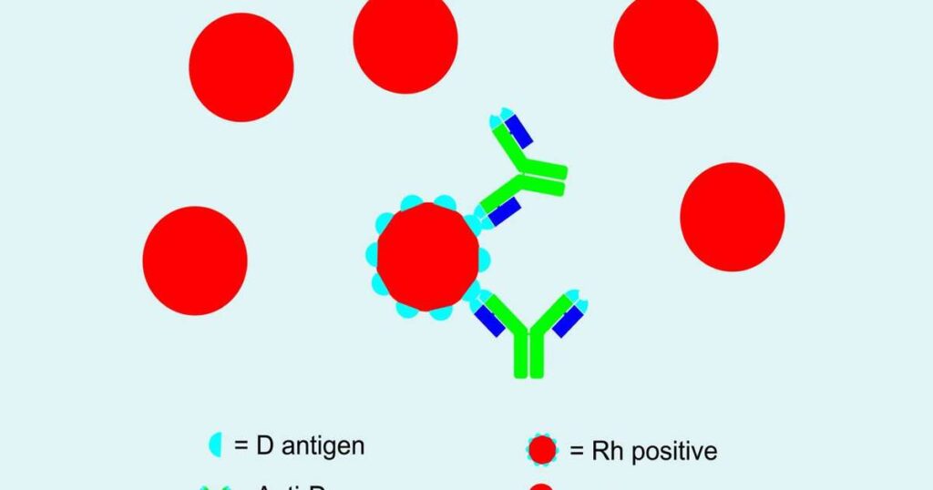 Gravidez saudável com anticorpo Anti-D
